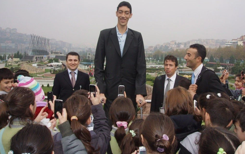 张俊才出生于1966年，是中国最高的男子之一，身高2.41935米
